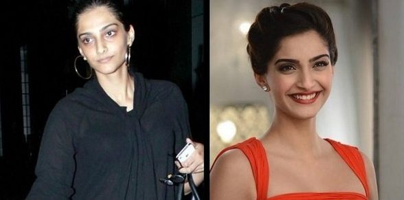 Sonam Kapoor e1509080922800 Arena Pile Top 10 Bollywood Actress Who Turned Ugly to Beautiful 2017