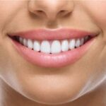 Temporary Vs Permanent Dental Crown